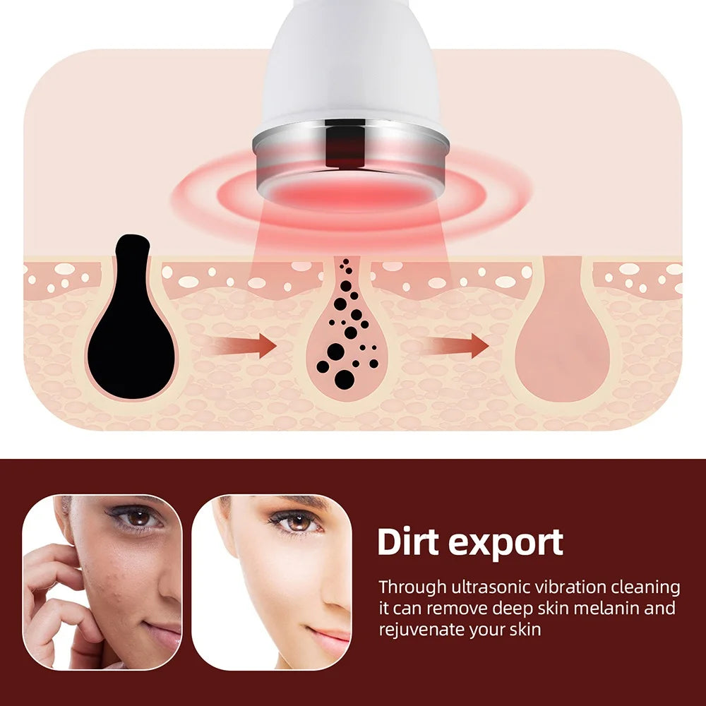 Ultrasonic Skin Care Beauty Machine