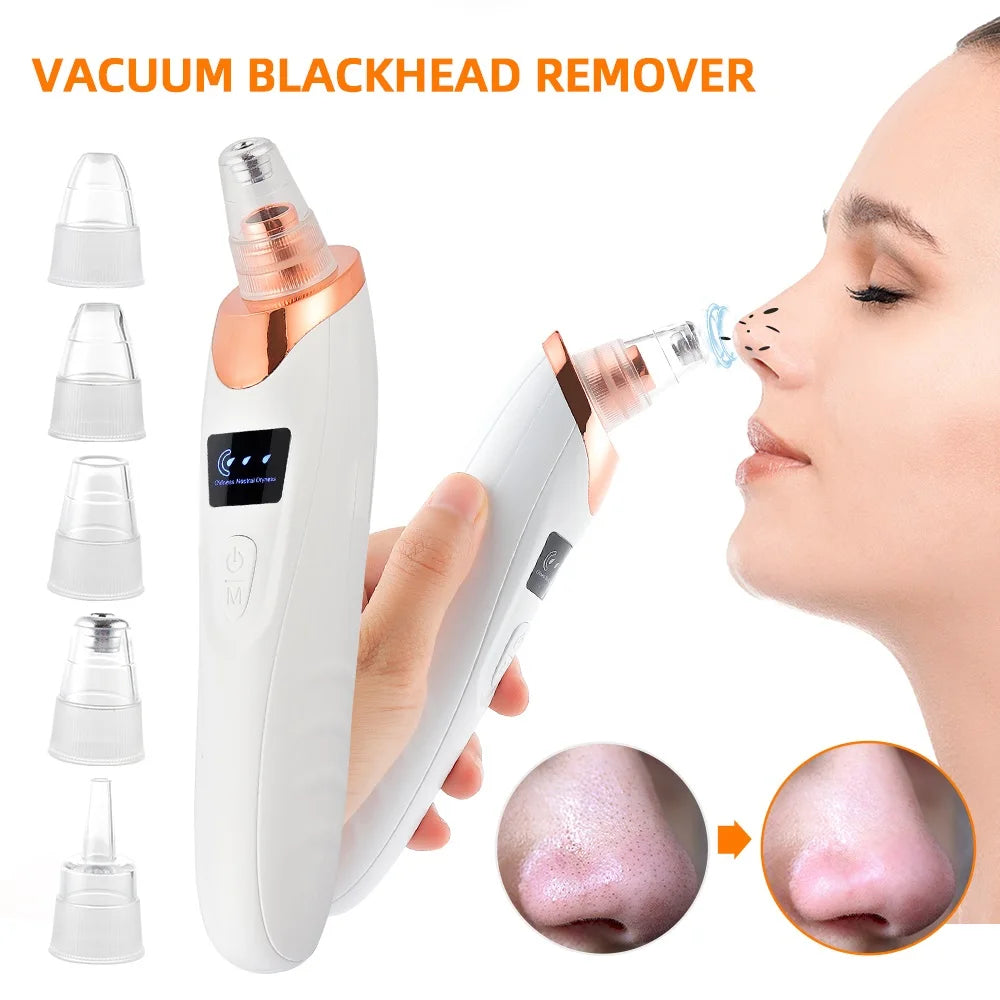 Vacuum Blackhead Remover
